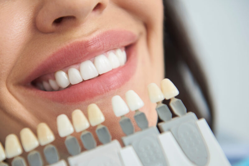 Risks of At-Home Teeth Whitening To Understand